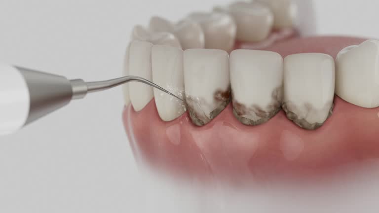 Reliable Dental contractor in Henderson, TX by Dentist Open Now